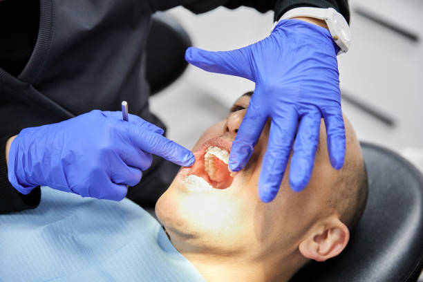 Best Emergency Dentist for Lost Fillings or Crowns in Port Monmouth, NJ